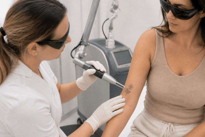 comment fonctionne le détatouage laser